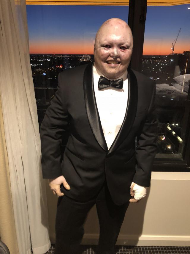 Disability advocates celebrate Disability Action Week Gympie Today